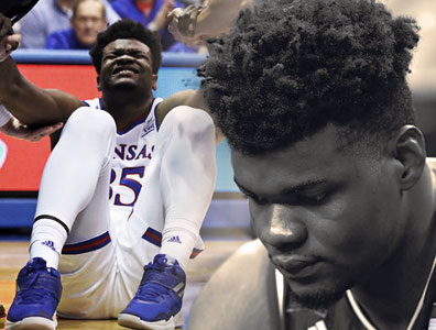 उदोका के टखने में चोट लग गई